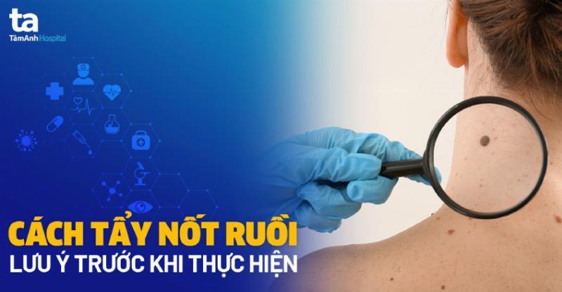 Chăm sóc vùng kín sau khi loại bỏ nốt ruồi