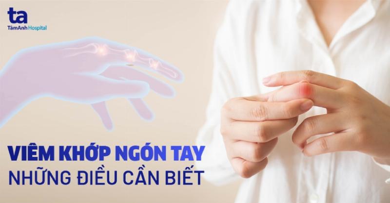 Ngón tay cái 4 đốt: Minh họa trường hợp đột biến