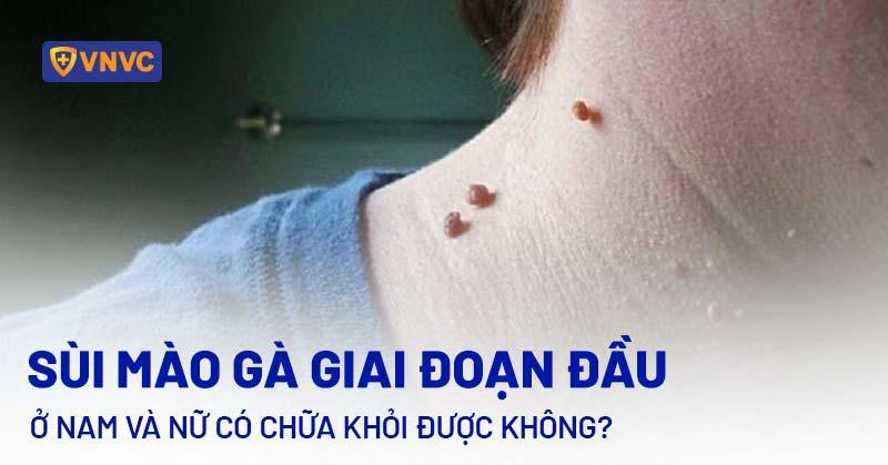 Nốt Ruồi Vùng Kín và Quan Hệ Tình Dục