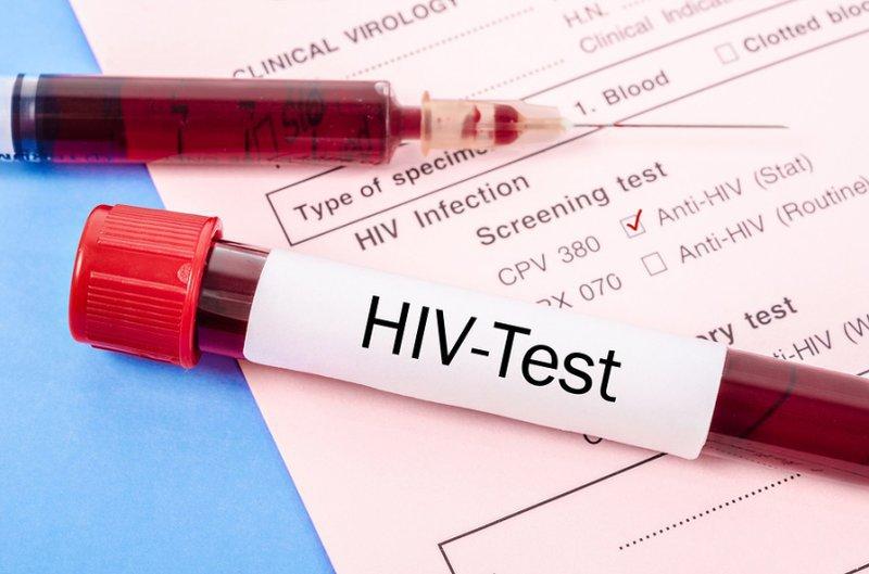 Xét nghiệm HIV